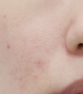 After